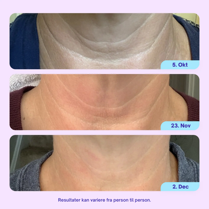 NeckLift™ Firming Cream – Opstrammende Halscreme Mod Slap Hud & Dobbelthage