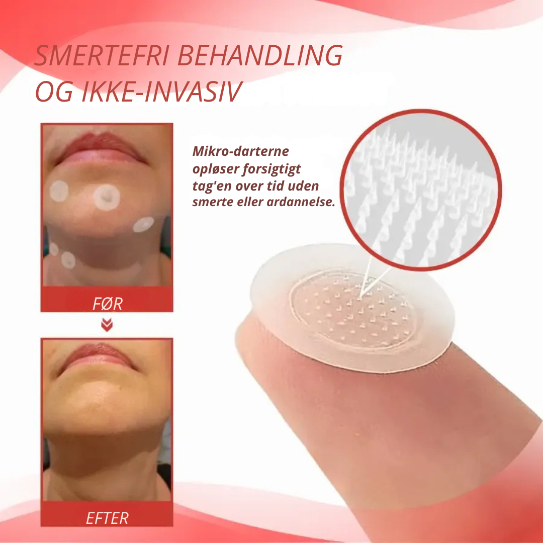 HudKlar™ | Målrettede mikronåleplastre til hudvorter og små hudknopper