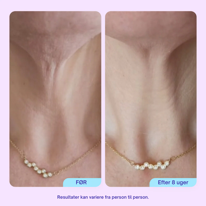 NeckLift™ Firming Cream – Opstrammende Halscreme Mod Slap Hud & Dobbelthage