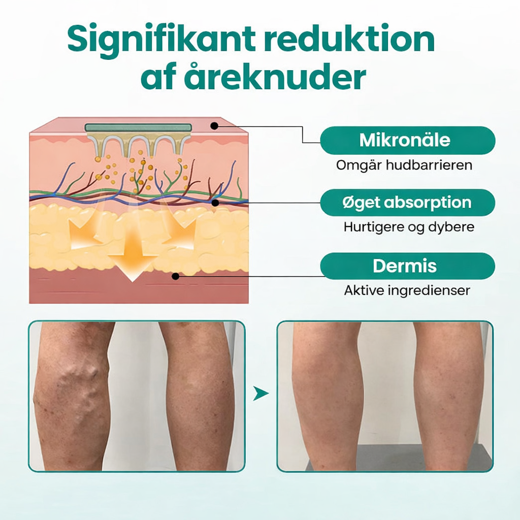 VeinHeal™ – Slip for tunge og trætte ben