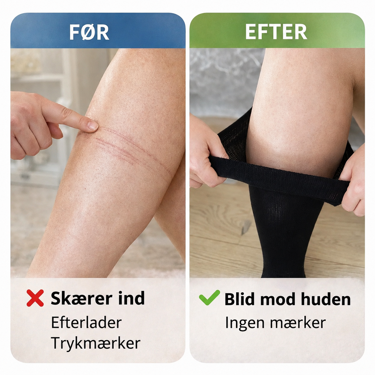Venora™ Kompressionsstrømper, Du Faktisk Har Lyst til at Have På