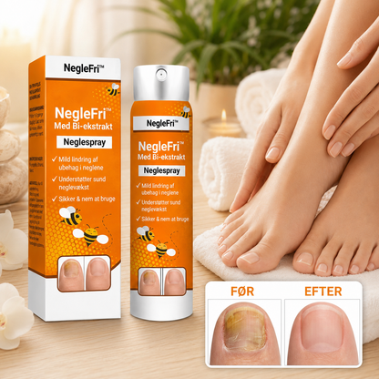 NegleFri™ | Hurtig lindring af negleproblemer – Fremmer sunde, klare negle