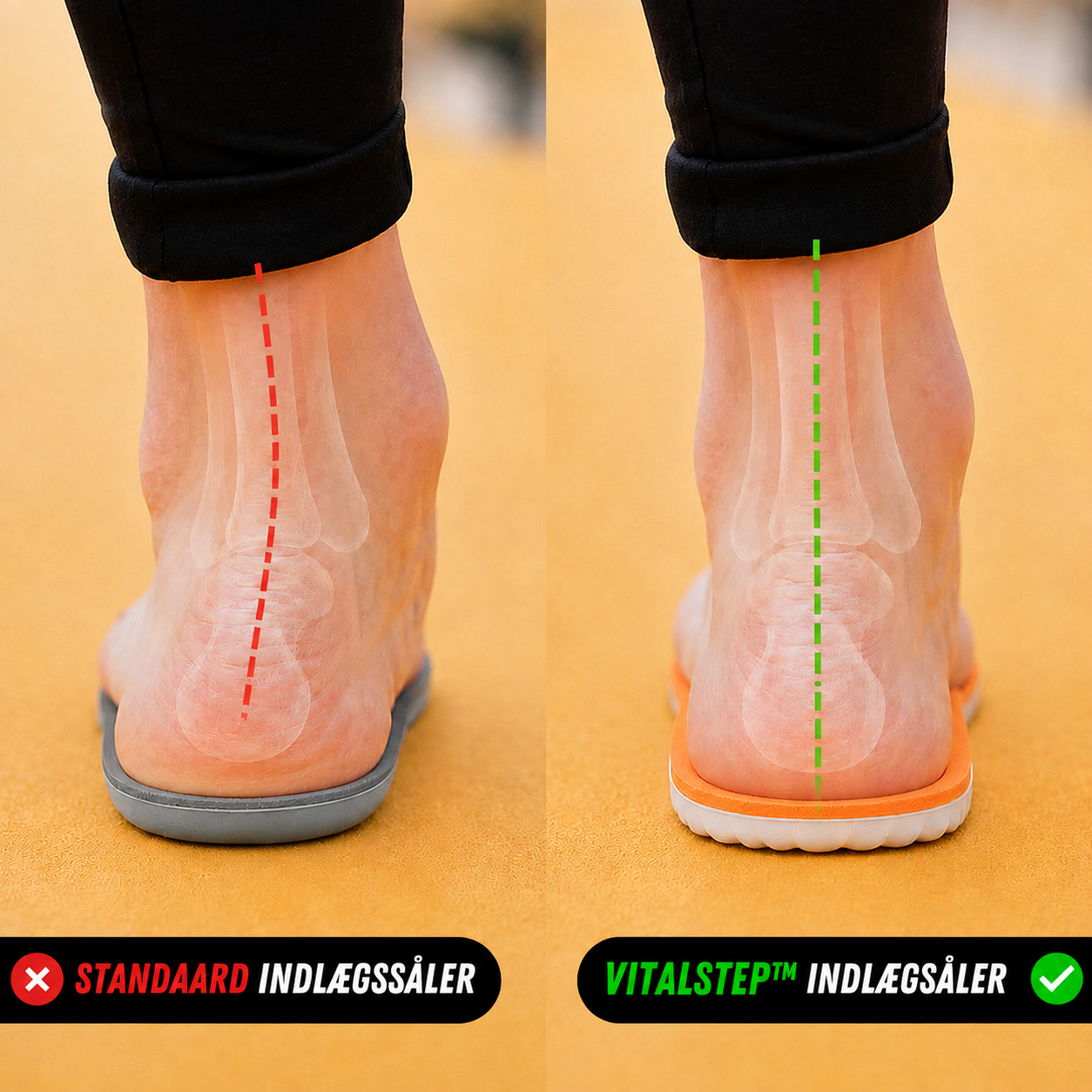 VitalStep™ – Ergonomiske Indlægssåler Til Hælspore, Fodsmerter & Ømme Fødder
